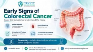 early signs of colorectal cancer
